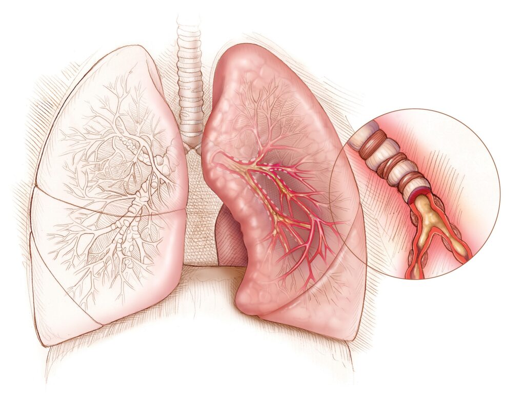 asthma specialist in nashik asthma specialist near me