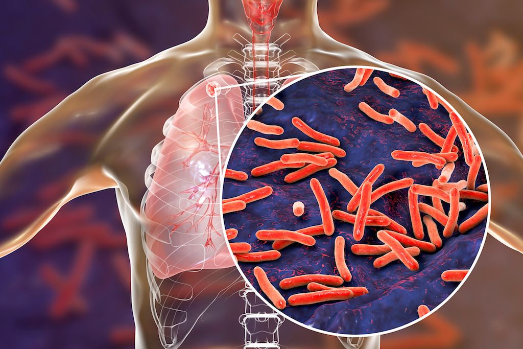 tb specialist in nashik, best tb doctor in nashik